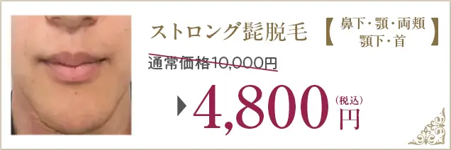 ストロング髭脱毛、通常価格10,000円が4,800円